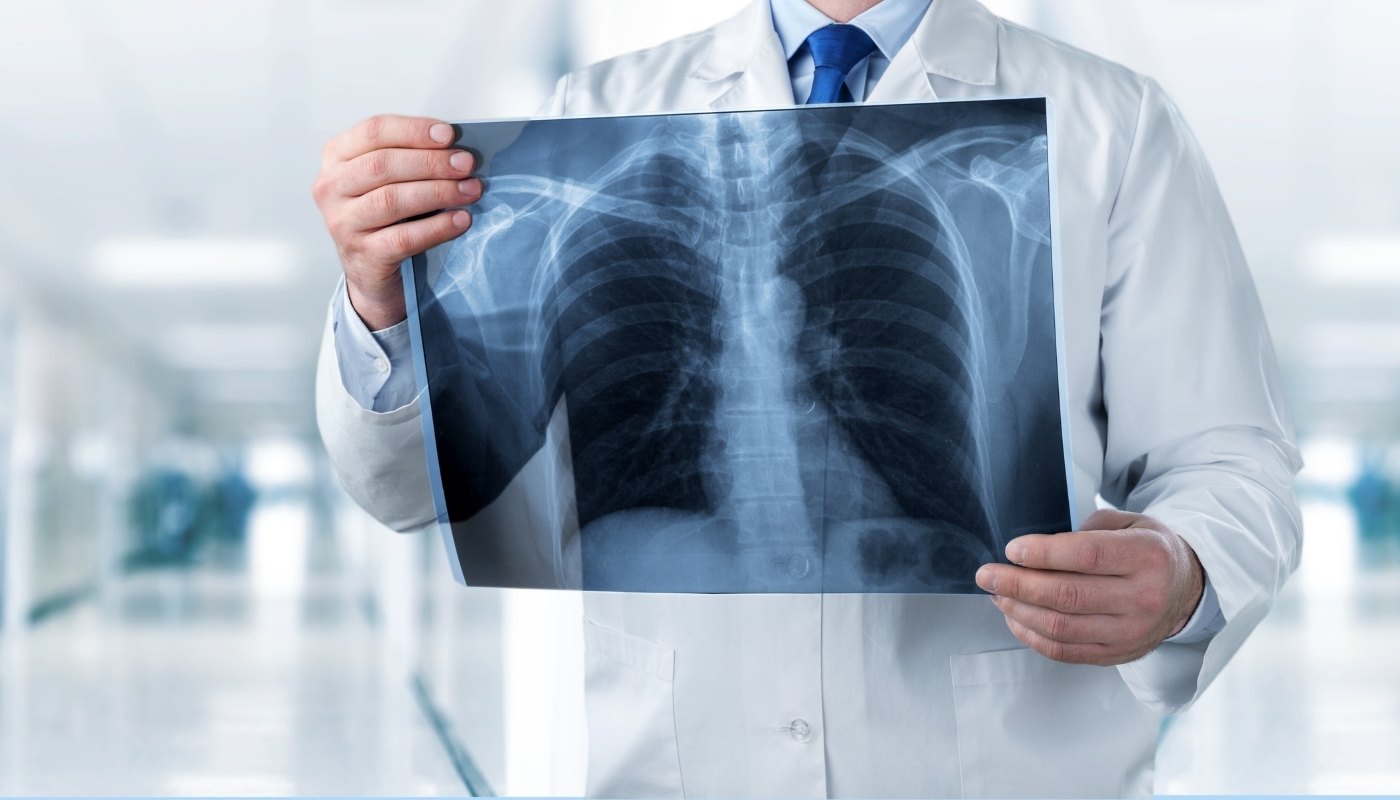 Interventional Radiology Procedures Turkey