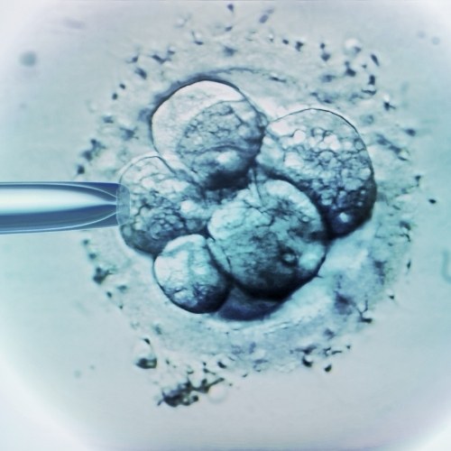 In Vitro Fertilization (IVF) Turkey