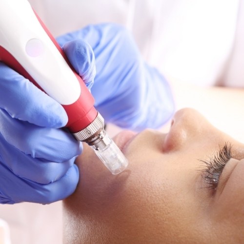 Golden Needle Treatment Turkey