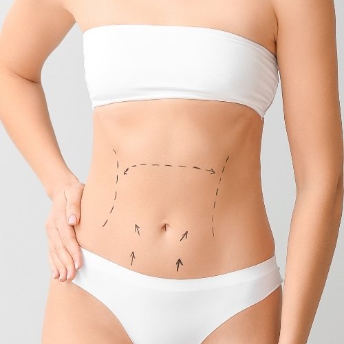 Laser-Vaser Liposuction Istanbul, Turkey
